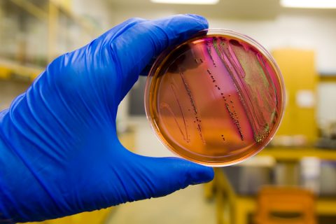 E. coli O157:H7 Outbreaks: When Science Speaks but No One Listens