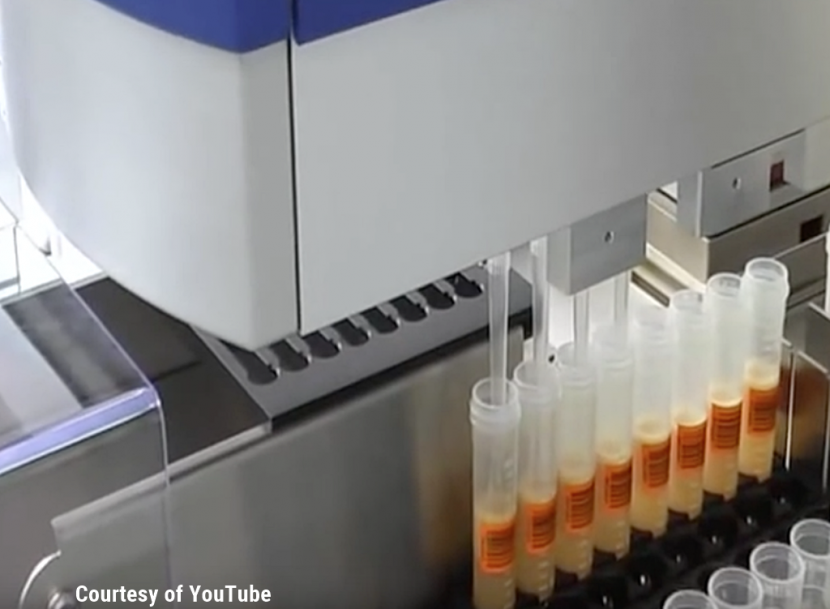 Are Pathogens Sneaking Past Your Sampling Method? Automate to Minimize Your Business Risk