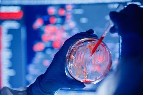 BioSensors are the Future for Diagnosing Foodborne Pathogens